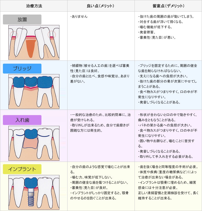 審美歯科の種類と特徴