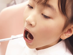 小児歯科の治療について